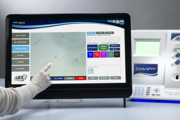 Automated Semen Analyzer