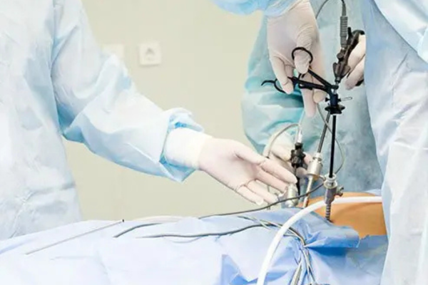 Laparoscopy Procedure