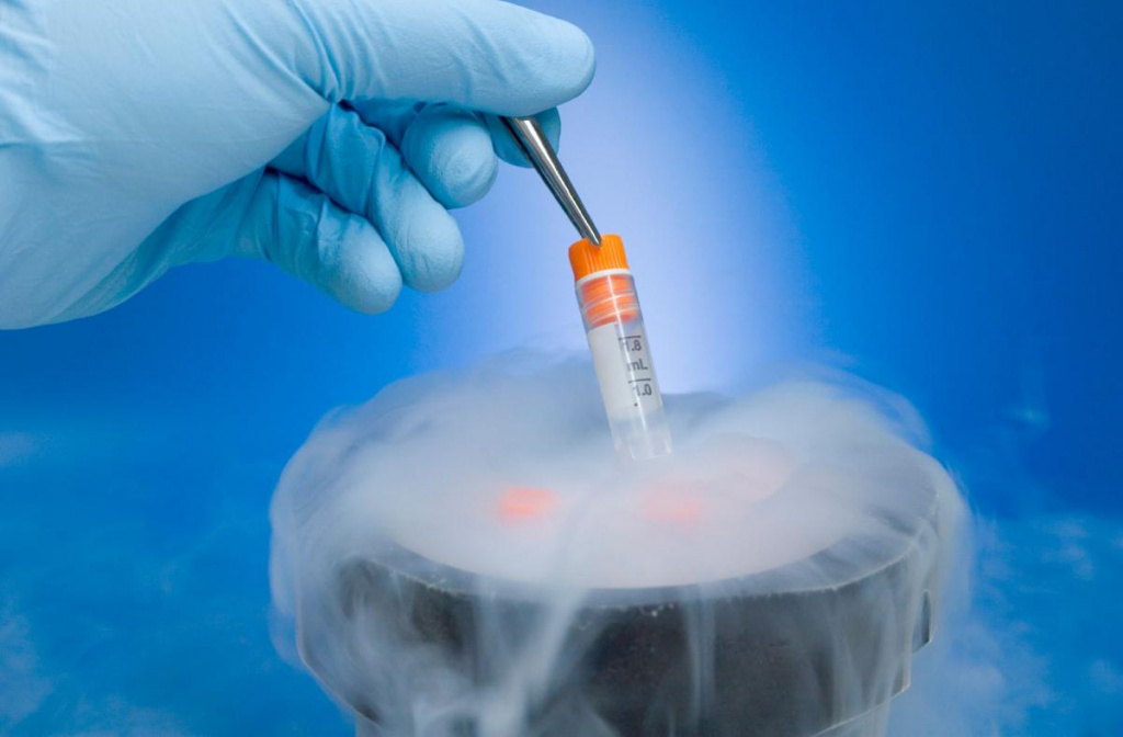 Semen Freezing
